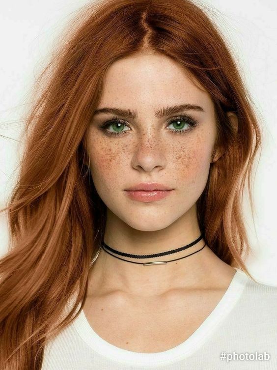 freckles shown